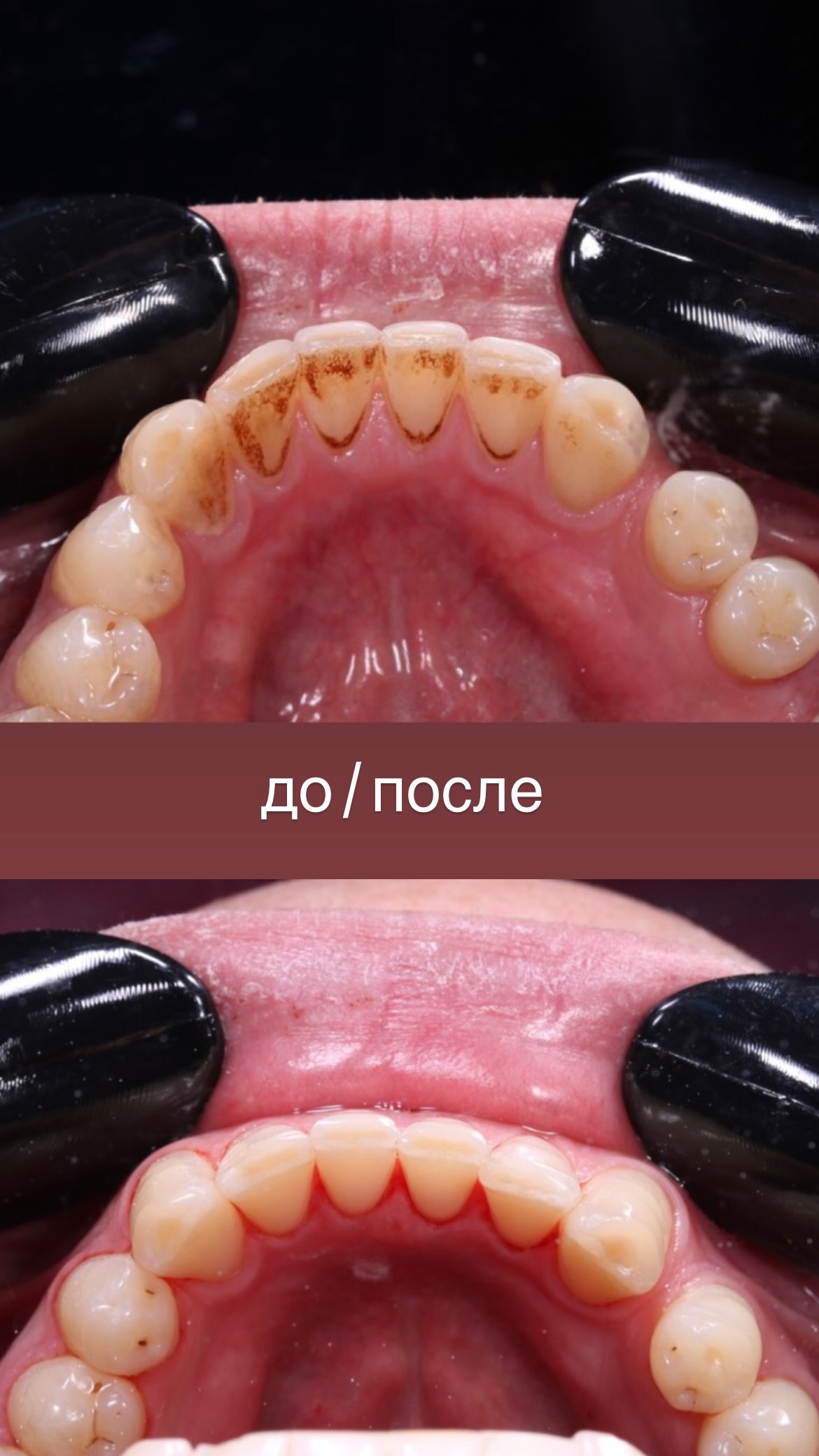 Работа — до/после