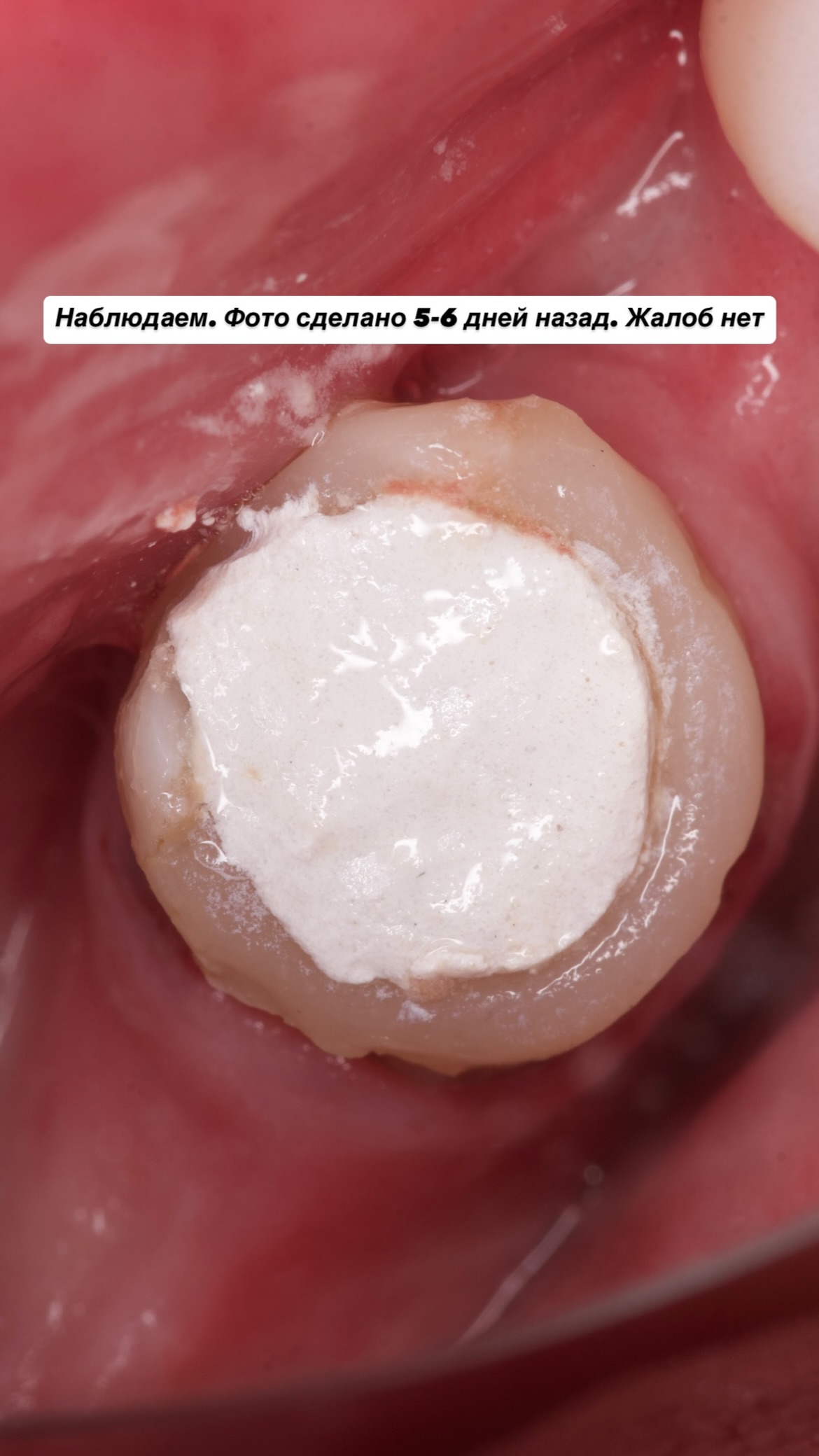 Работа — до/после