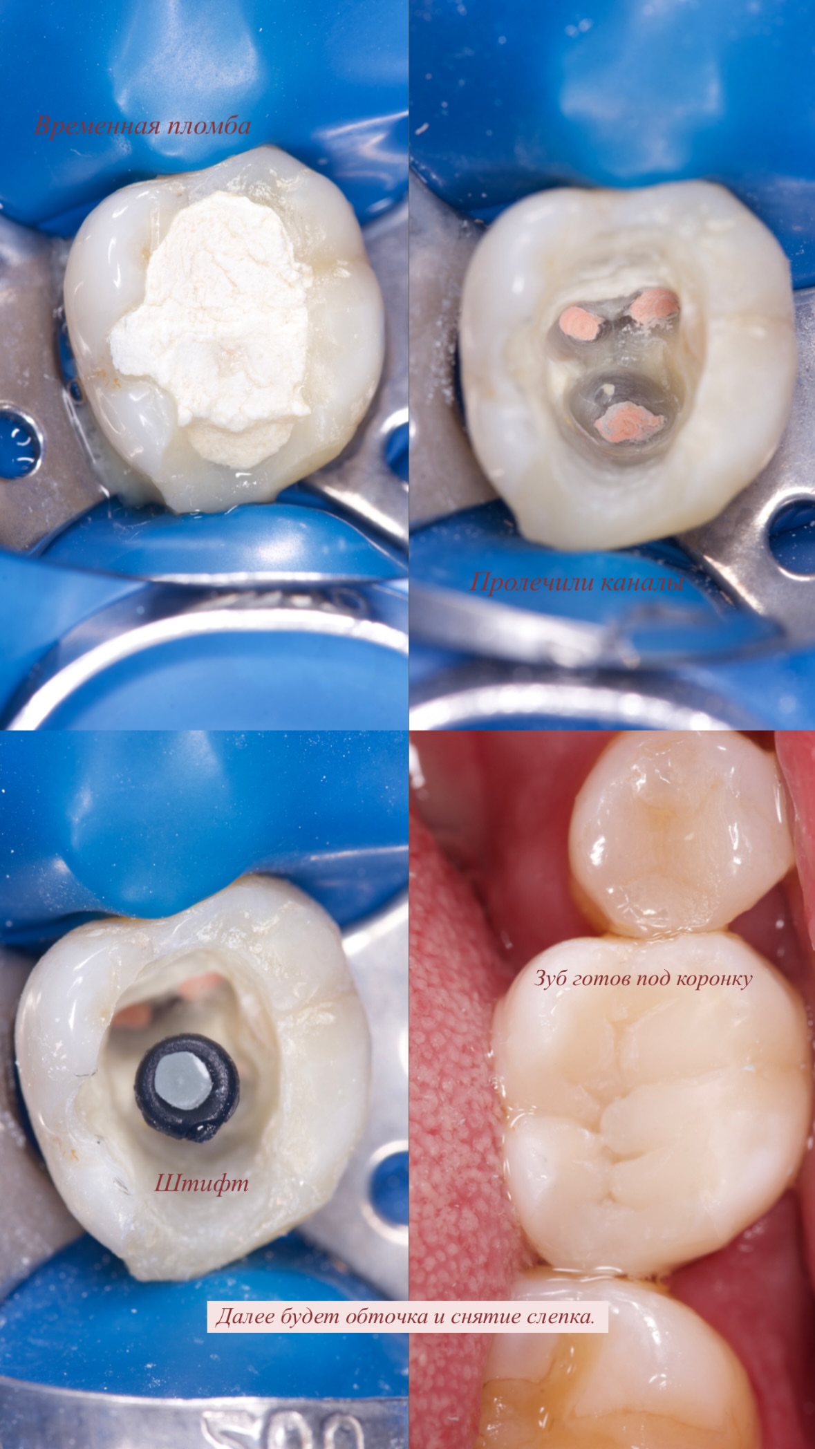 Работа — до/после