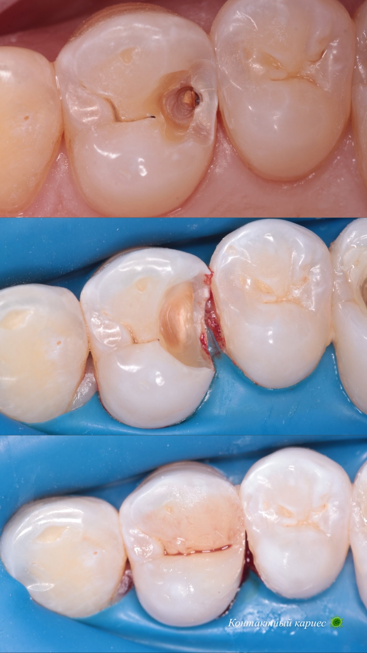 Работа — до/после