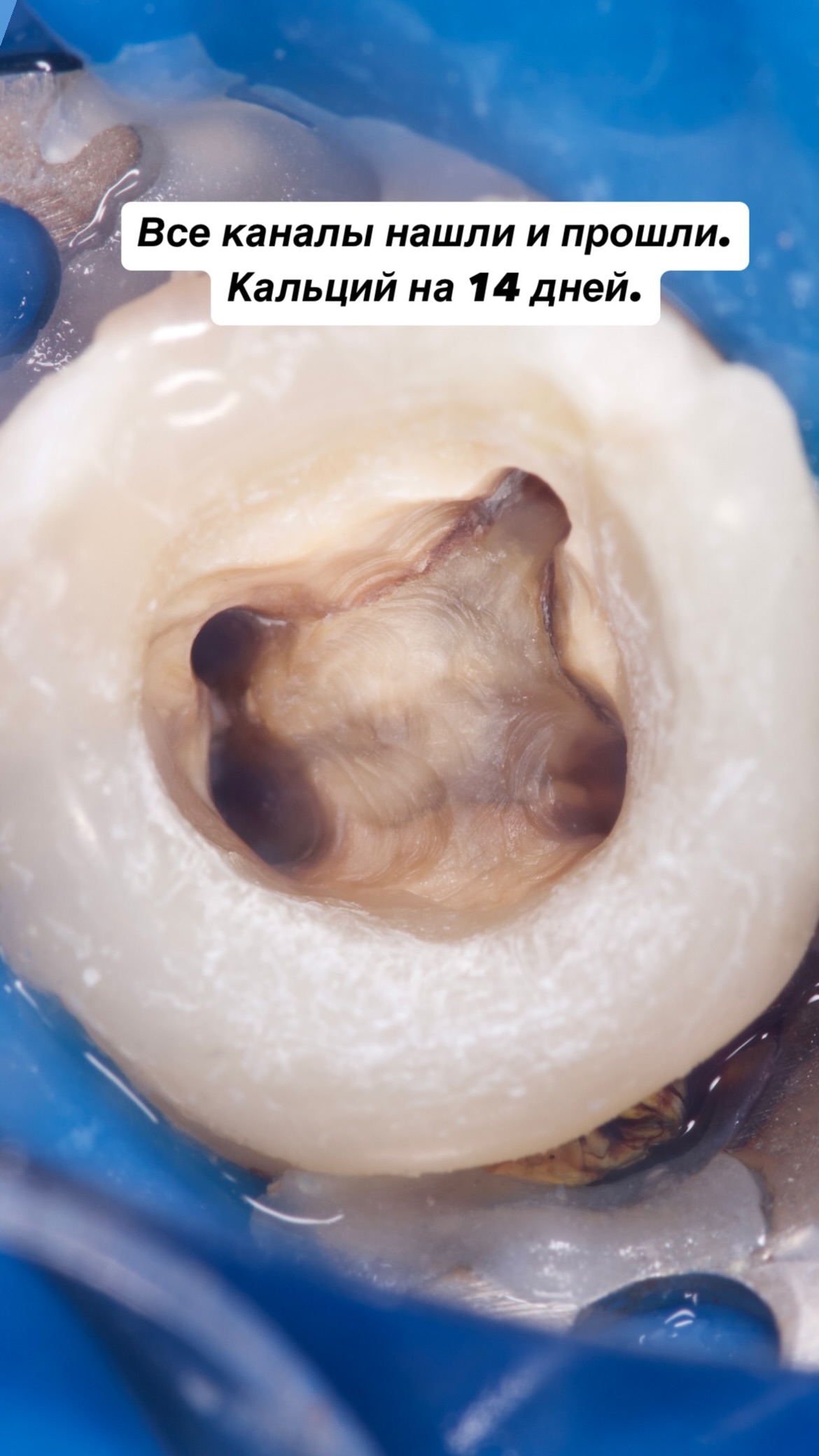 Работа — до/после