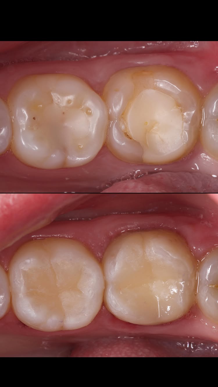 Стоматолог VitaWay за работой